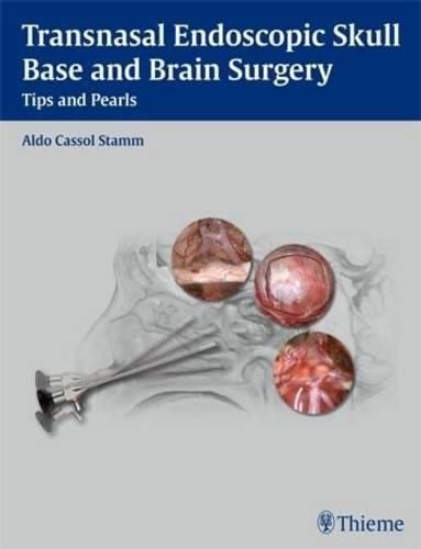 Cover image for Transnasal Endoscopic Skull Base and Brain Surgery: Tips and Pearls