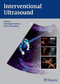 Cover image for Interventional Ultrasound: A Practical Guide and Atlas