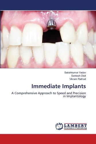 Cover image for Immediate Implants