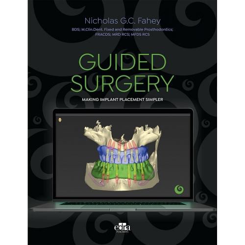 Cover image for Guided Surgery