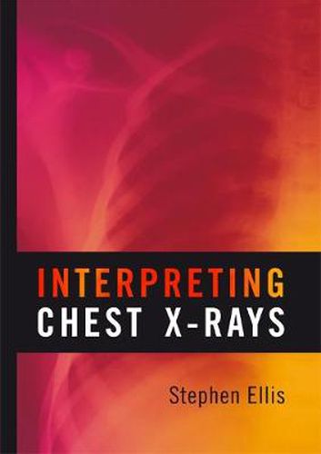 Cover image for Interpreting Chest X-Rays