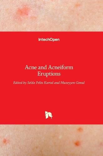 Cover image for Acne and Acneiform Eruptions