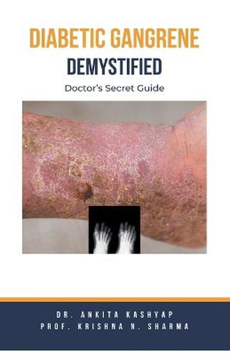 Cover image for Diabetic Gangrene Demystified