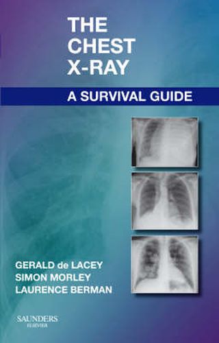 Cover image for The Chest X-Ray: A Survival Guide