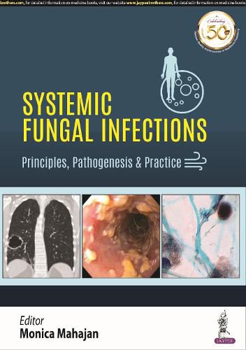 Cover image for Systemic Fungal Infections: Principles, Pathogenesis & Practice