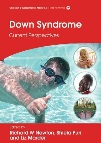 Cover image for Down Syndrome: Current Perspectives