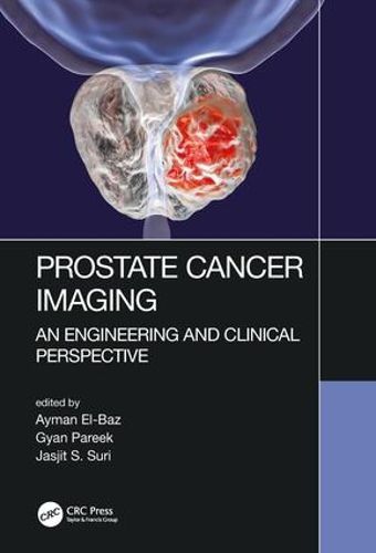 Cover image for Prostate Cancer Imaging: An Engineering and Clinical Perspective