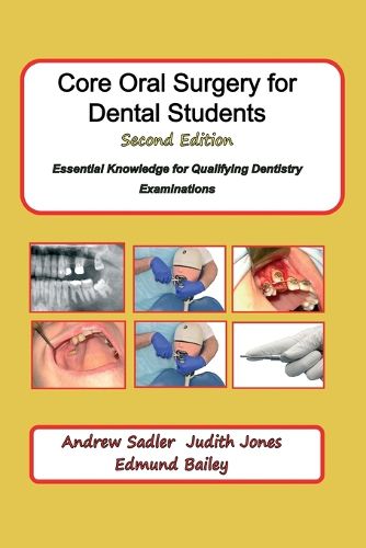 Core Oral Surgery for Dental Students Second Edition