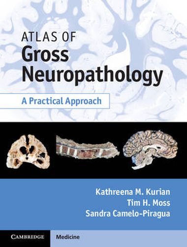 Cover image for Atlas of Gross Neuropathology Book and Online Bundle: A Practical Approach