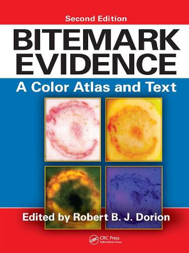 Cover image for Bitemark Evidence
