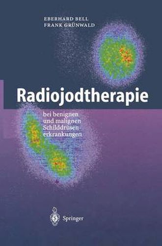 Cover image for Radiojodtherapie: Bei Benignen Und Malignen Schilddrusenerkrankungen