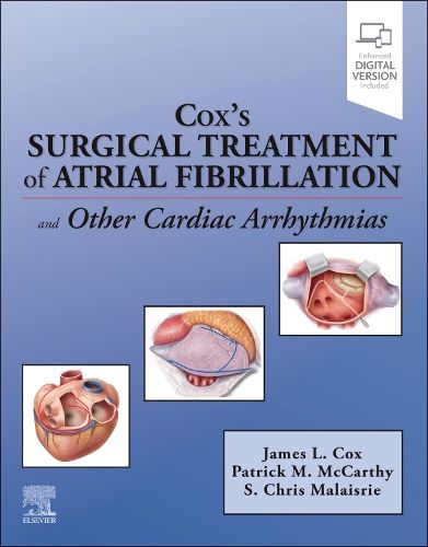 Cover image for Cox's Surgical Treatment of Atrial Fibrillation