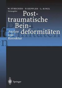 Cover image for Posttraumatische Beindeformitaten: Analyse und Korrektur