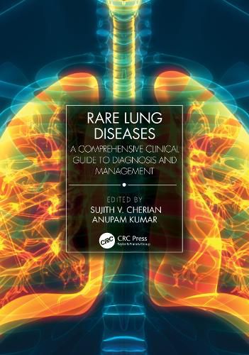 Cover image for Rare Lung Diseases: A Comprehensive Clinical Guide to Diagnosis and Management