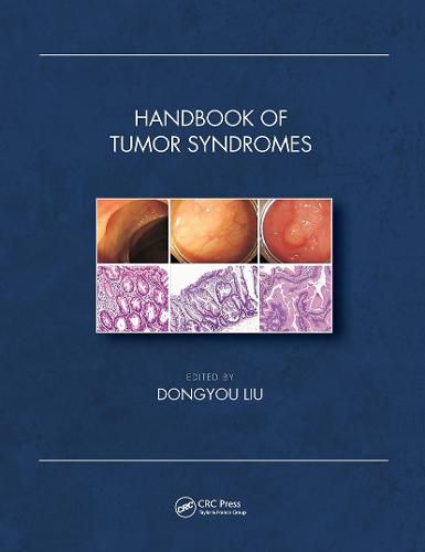Cover image for Handbook of Tumor Syndromes