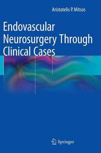 Cover image for Endovascular Neurosurgery Through Clinical Cases