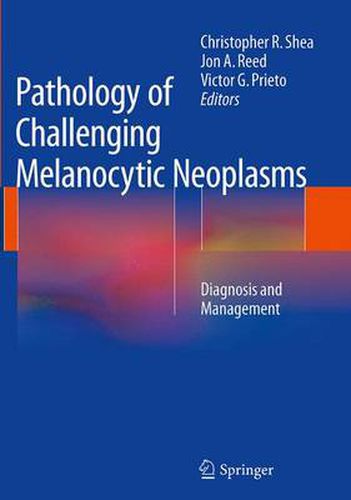 Cover image for Pathology of Challenging Melanocytic Neoplasms: Diagnosis and Management