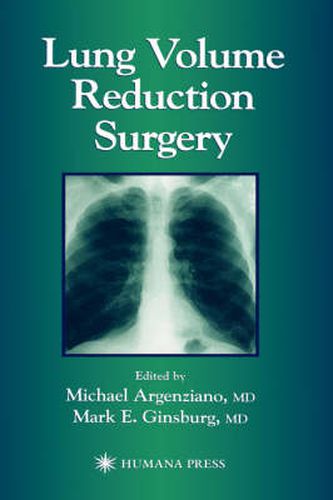 Cover image for Lung Volume Reduction Surgery