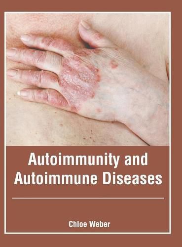 Cover image for Autoimmunity and Autoimmune Diseases