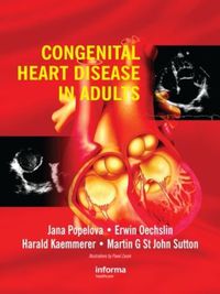 Cover image for Congenital Heart Disease in Adults