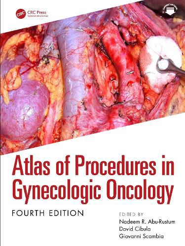 Cover image for Atlas of Procedures in Gynecologic Oncology