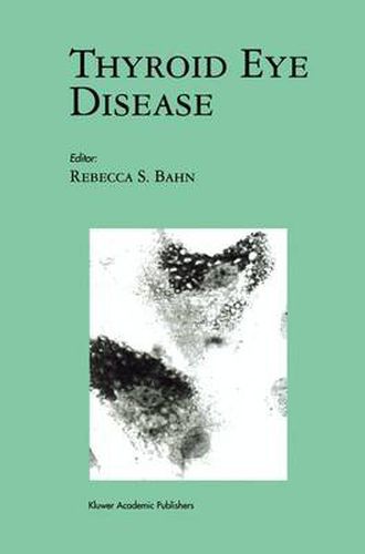 Cover image for Thyroid Eye Disease