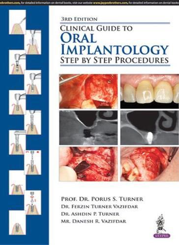 Cover image for Clinical Guide to Oral Implantology: Step by Step Procedures