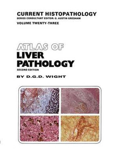 Cover image for Atlas of Liver Pathology