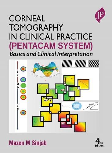 Cover image for Corneal Tomography in Clinical Practice (Pentacam System)