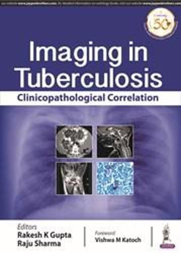 Cover image for Imaging in Tuberculosis: Clinicopathological Correlation