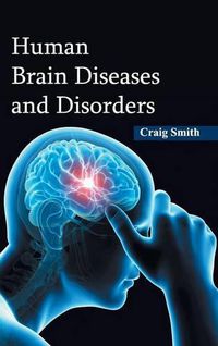 Cover image for Human Brain Diseases and Disorders