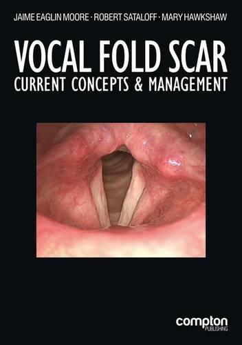 Vocal Fold Scar: Current Concepts and Management