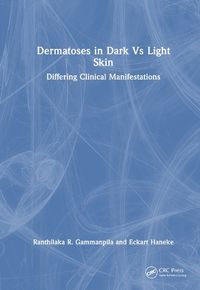 Cover image for Dermatoses in Dark Vs Light Skin