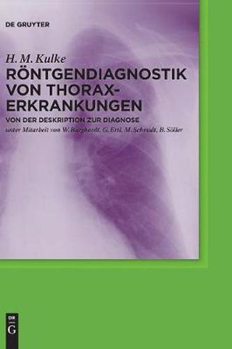 Cover image for Roentgendiagnostik von Thoraxerkrankungen