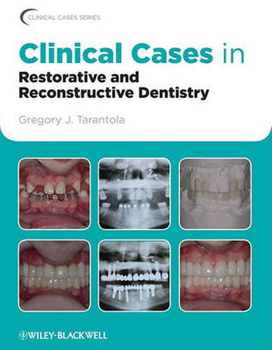 Cover image for Clinical Cases in Restorative and Reconstructive Dentistry