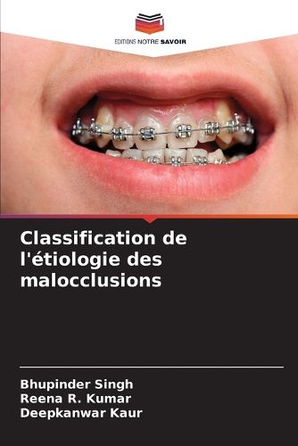 Cover image for Classification de l'etiologie des malocclusions