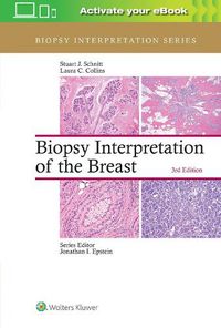 Cover image for Biopsy Interpretation of the Breast