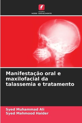 Cover image for Manifestacao oral e maxilofacial da talassemia e tratamento