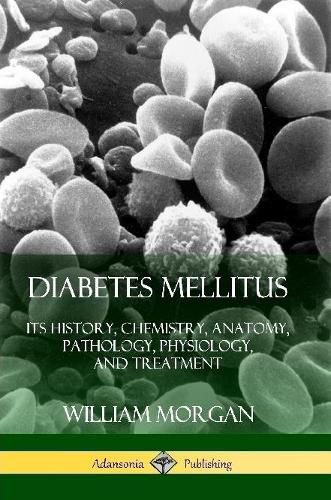 Cover image for Diabetes Mellitus: Its History, Chemistry, Anatomy, Pathology, Physiology, and Treatment