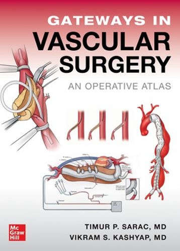 Cover image for Gateways in Vascular Surgery: An Operative Atlas