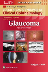 Cover image for Glaucoma