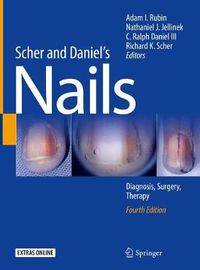 Cover image for Scher and Daniel's Nails: Diagnosis, Surgery, Therapy