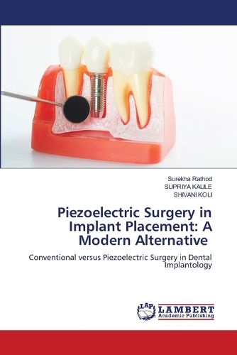 Cover image for Piezoelectric Surgery in Implant Placement