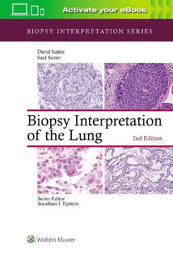 Cover image for Biopsy Interpretation of the Lung