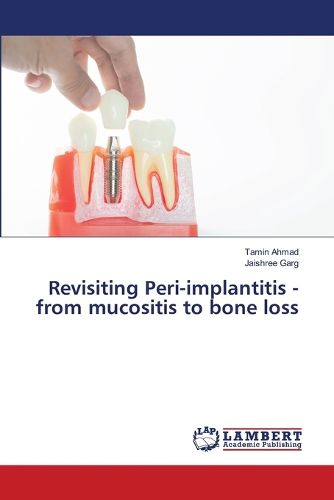 Cover image for Revisiting Peri-implantitis - from mucositis to bone loss