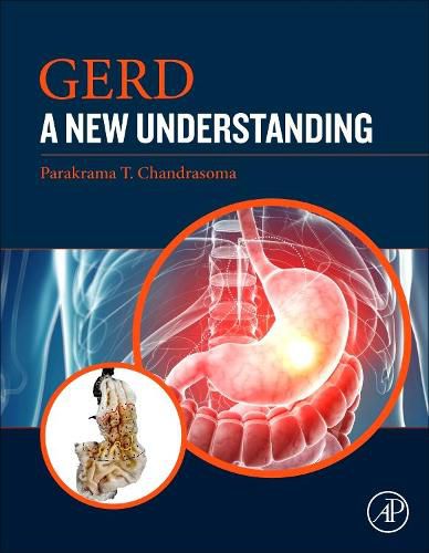 Cover image for GERD: A New Understanding of Pathology, Pathophysiology, and Treatment