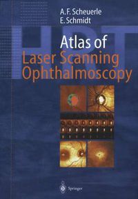 Cover image for Atlas of Laser Scanning Ophthalmoscopy