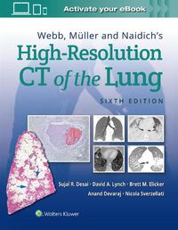 Cover image for Webb, Muller and Naidich's High-Resolution CT of the Lung