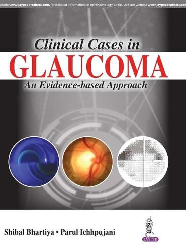Cover image for Clinical Cases in Glaucoma: An Evidence Based Approach