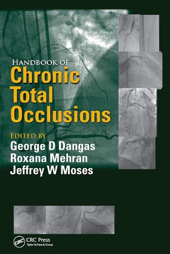 Cover image for Handbook of Chronic Total Occlusions